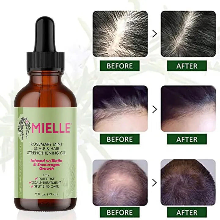 Rosemary Mint Scalp Oil Strengthens Scalp Hair & Boost Growth (Original Import)