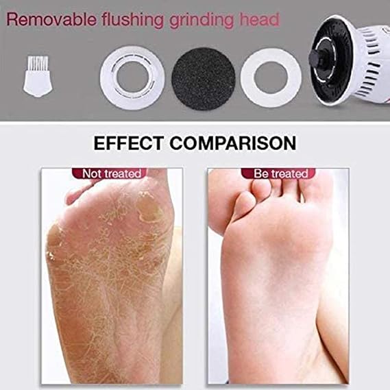 Emi's Fashion Ultimate Foot Care Callus Remover