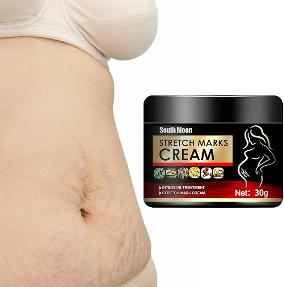 Stretch Marks Removal Cream,Scar Removal Cream - Stretch Mark Cream Remover for Pregnancy Skin Care, Stretch Marks Scar Remove