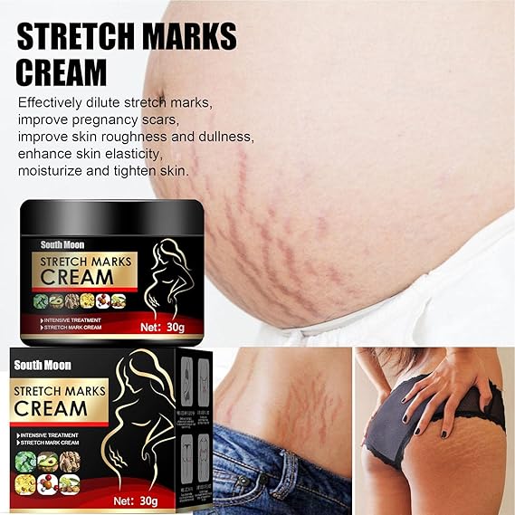 Stretch Marks Removal Cream,Scar Removal Cream - Stretch Mark Cream Remover for Pregnancy Skin Care, Stretch Marks Scar Remove