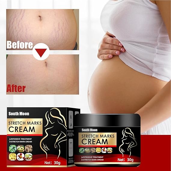 Stretch Marks Removal Cream,Scar Removal Cream - Stretch Mark Cream Remover for Pregnancy Skin Care, Stretch Marks Scar Remove