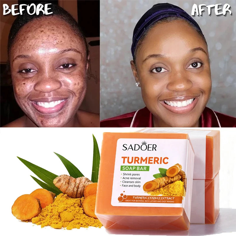 Turmeric + Kojic acid Soap Face Cleansing and Brightening (BUY 1 GET 1 FREE)