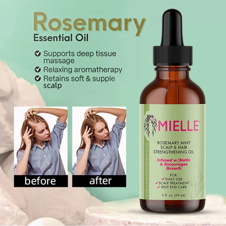 Rosemary Mint Scalp Oil Strengthens Scalp Hair & Boost Growth (Original Import)