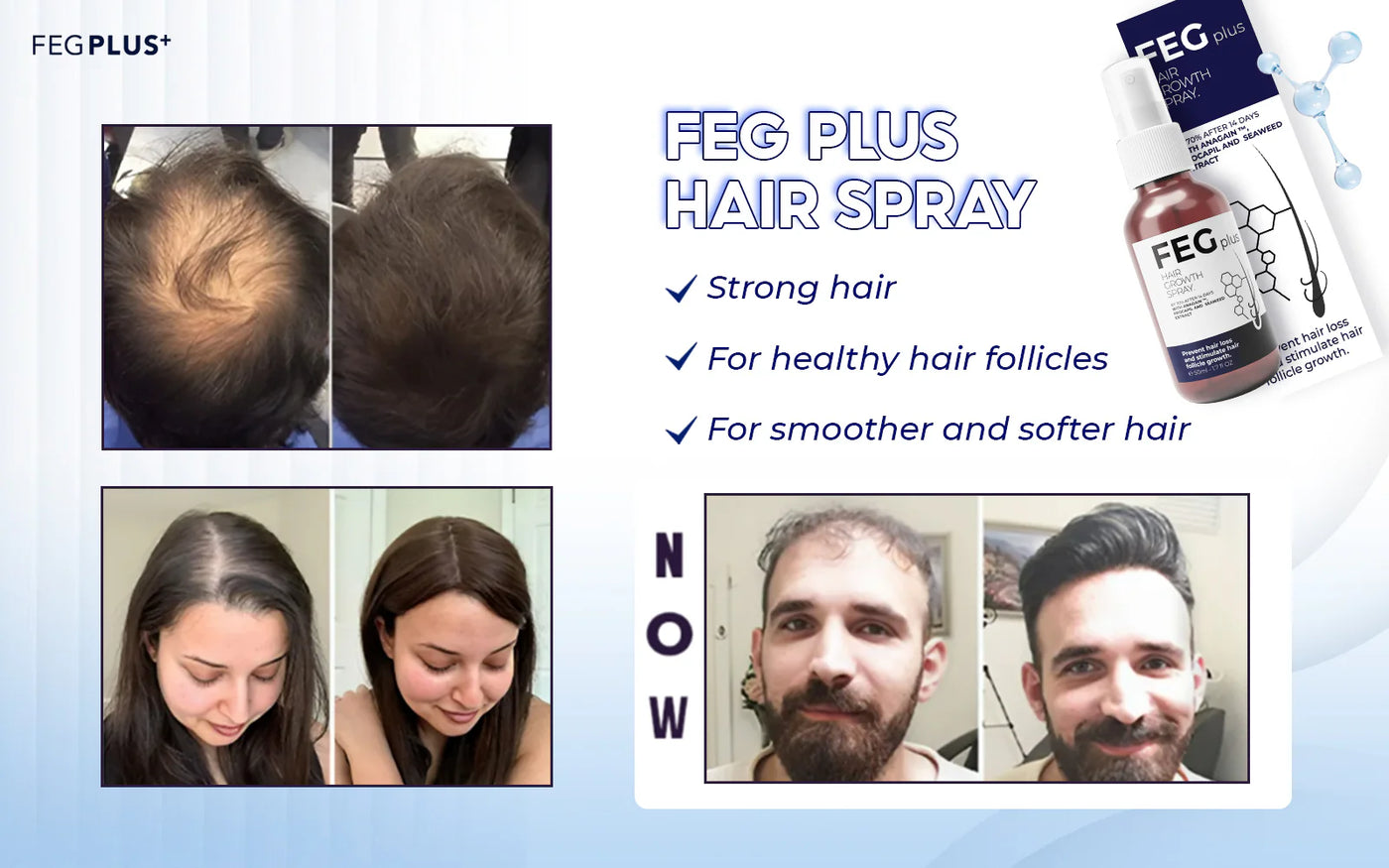 FEG Plus Hair Growth Spray ( Original Import )