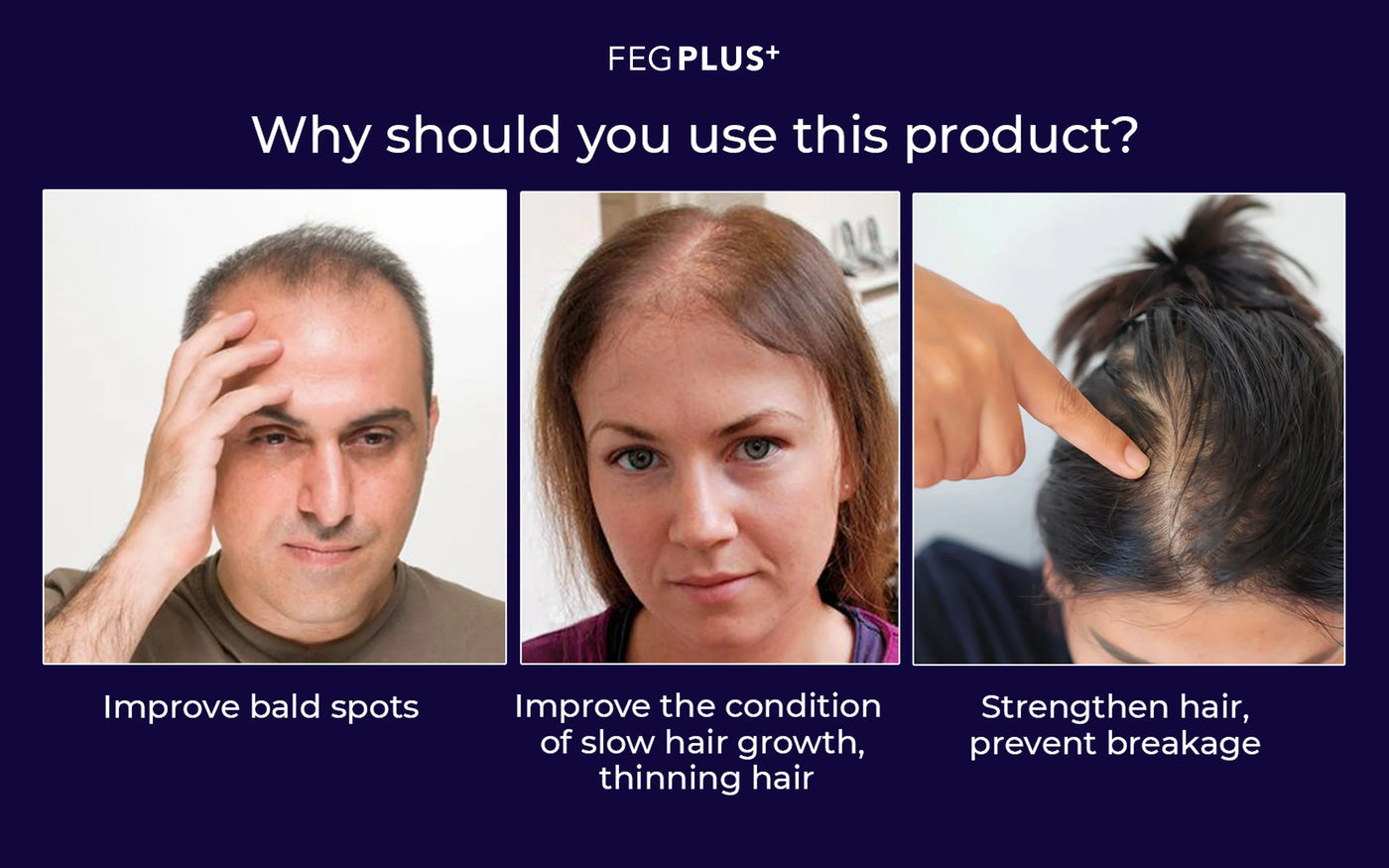 FEG Plus Hair Growth Spray ( Original Import )