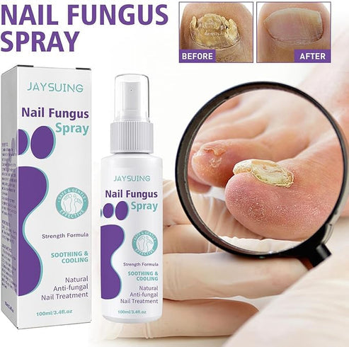 Emi's Nail Fungus Spray