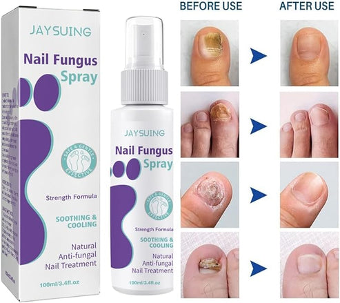 Emi's Nail Fungus Spray