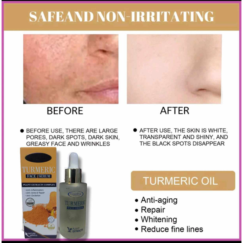 Turmeric Face Serum ( 100% Original Imported)